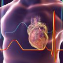 Diagnostyka mięśnia sercowego
